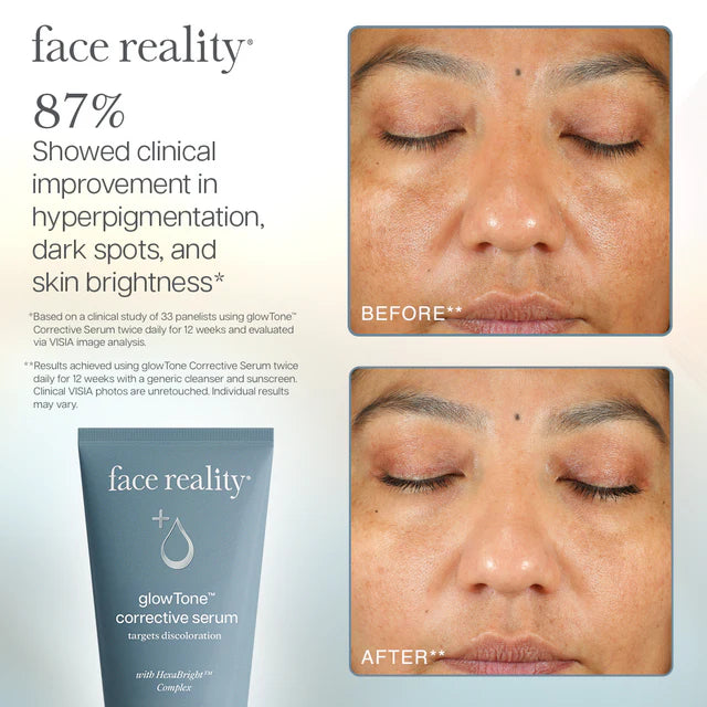 GlowTone Corrective Serum Secondary image